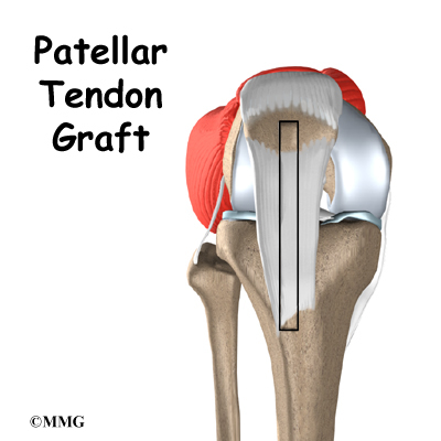 acl tendon
