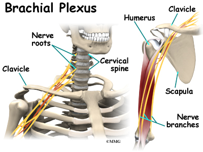 Brachial Plexus Block