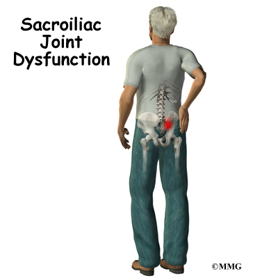Sacroiliac Joint Dysfunction | eOrthopod.com