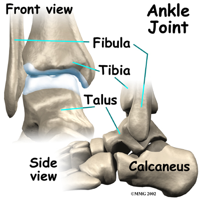 Ankle Replacement | eOrthopod.com