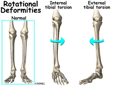 Image result for knee external rotation