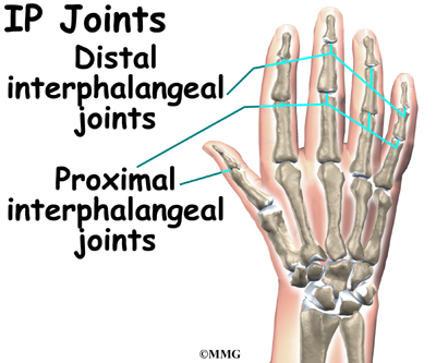 pip joint pain