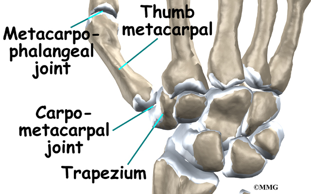 Thumb Fusion Surgery | eOrthopod.com