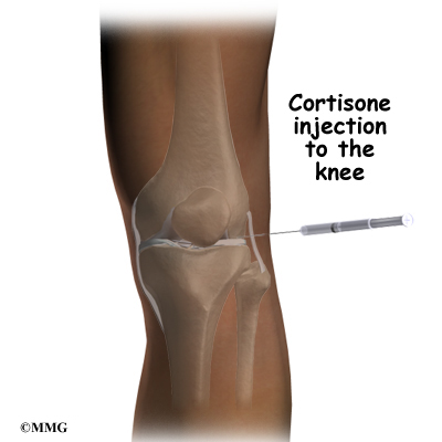 Corticosteroid knee injection amount