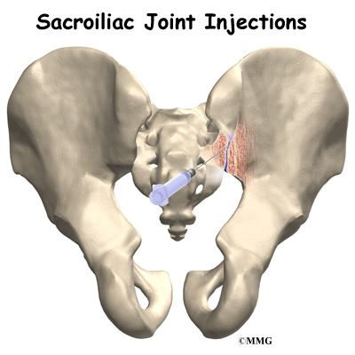 What are SI joints?
