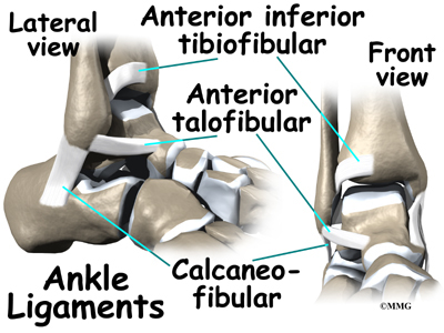 Anterior ankle impingement