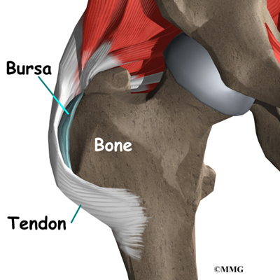 Hip Bursitis - Complete Orthopedics