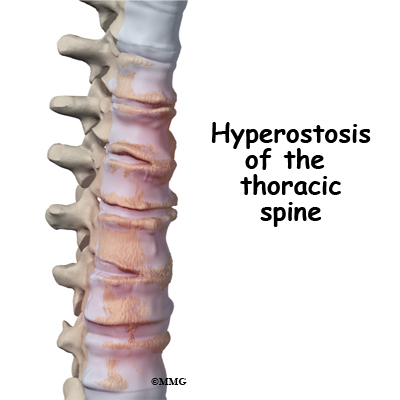 What is the thoracic spine and why is it important? - MyPhysio Evolution