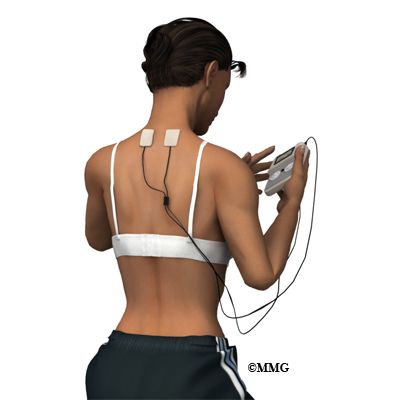 Transcutaneous Electrical Stimulation (TENS) for Cervical Spine Pain 
