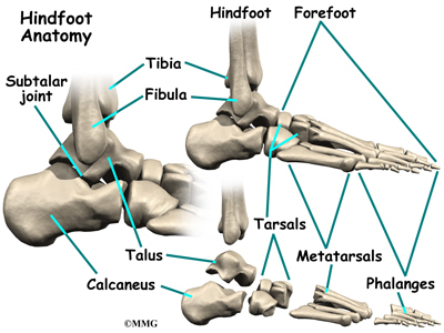 Adult-Acquired Flatfoot Deformity