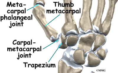 Resection (Excision) Arthroplasty of the Thumb - eOrthopod.com