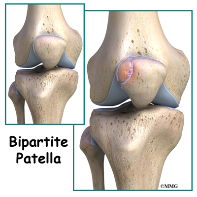 patella knee surgery