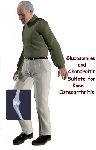 Glucosamine and Chondroitin Sulfate for Osteoarthritis of the Knee