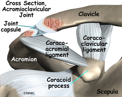 Illustrer Badeværelse detaljer Acromioclavicular Joint Separation - eOrthopod.com