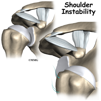 Shoulder Instability Osteopath