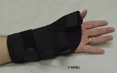 Scaphoid Fracture of the Wrist | eOrthopod.com