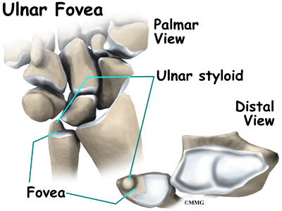 Triangular Fibrocartilage Complex Injuries